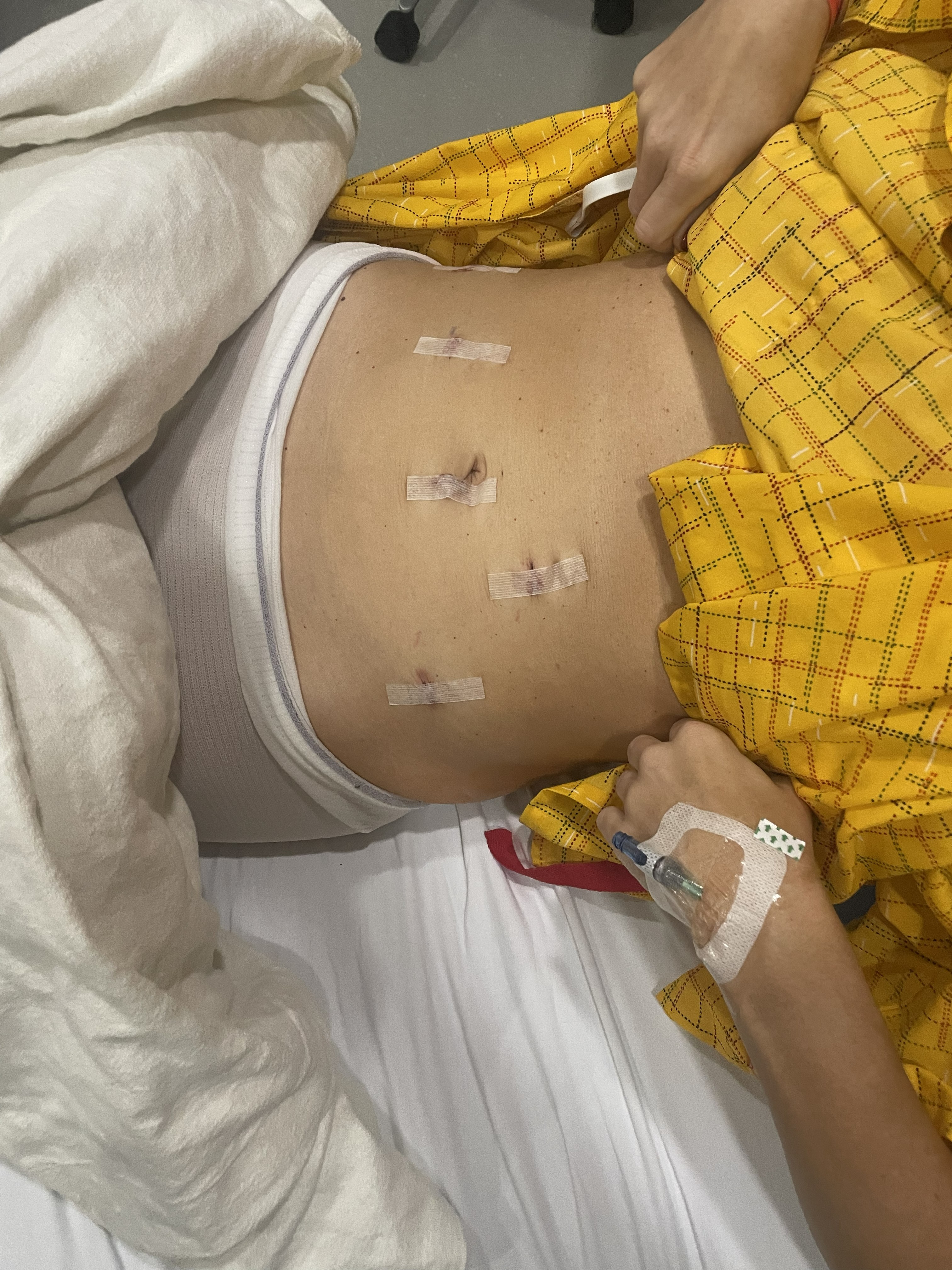 Robotic laparoscopic incisions